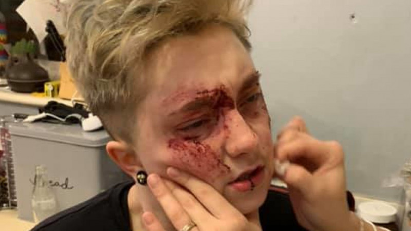 A 20-year-old lesbian was jumped in England